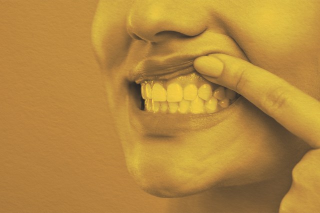 Close-up of a human smile with gums showing
